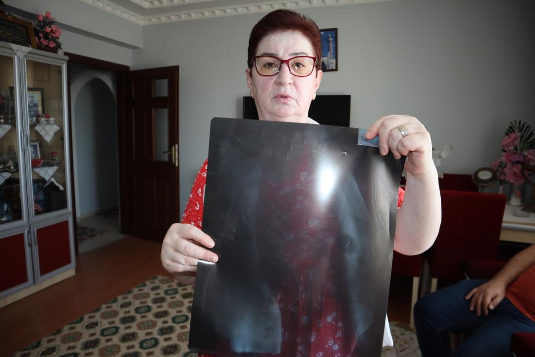 Tam 22 yıldır karnında yaşıyor! Riskli olduğu için çıkarılamıyor! "Yaşayan ölü gibiyim" 2