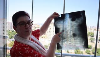22 yıldır karnında yaşıyor! Doktorlar çıkarmıyor: "Yaşayan ölüyüm"