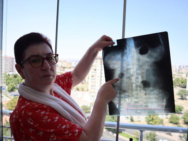 22 yıldır karnında yaşıyor! Doktorlar çıkarmıyor: "Yaşayan ölüyüm"