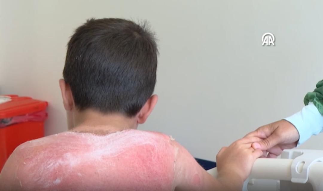 7 yaşındaki çocuk günlerdir hastanede! Uzmanlar uyardı 1