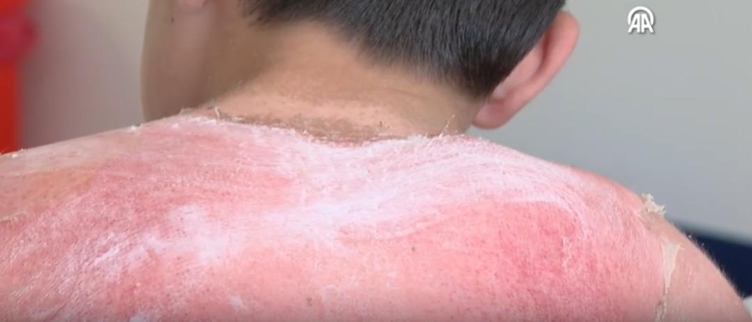 7 yaşındaki çocuk günlerdir hastanede! Uzmanlar uyardı 2