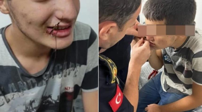 Ağzına balık oltası takılan çocuk, itfaiye ekiplerince kurtarıldı