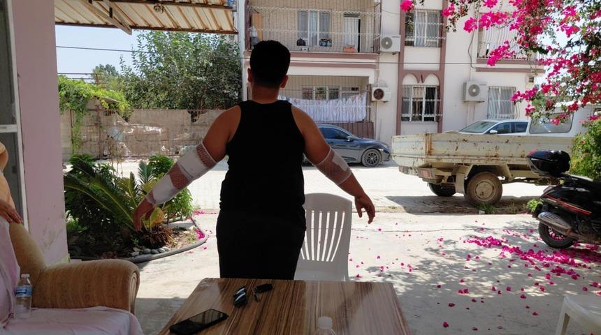 Hatay'da sahipsiz köpeğin saldırdığı çocuk yaralandı