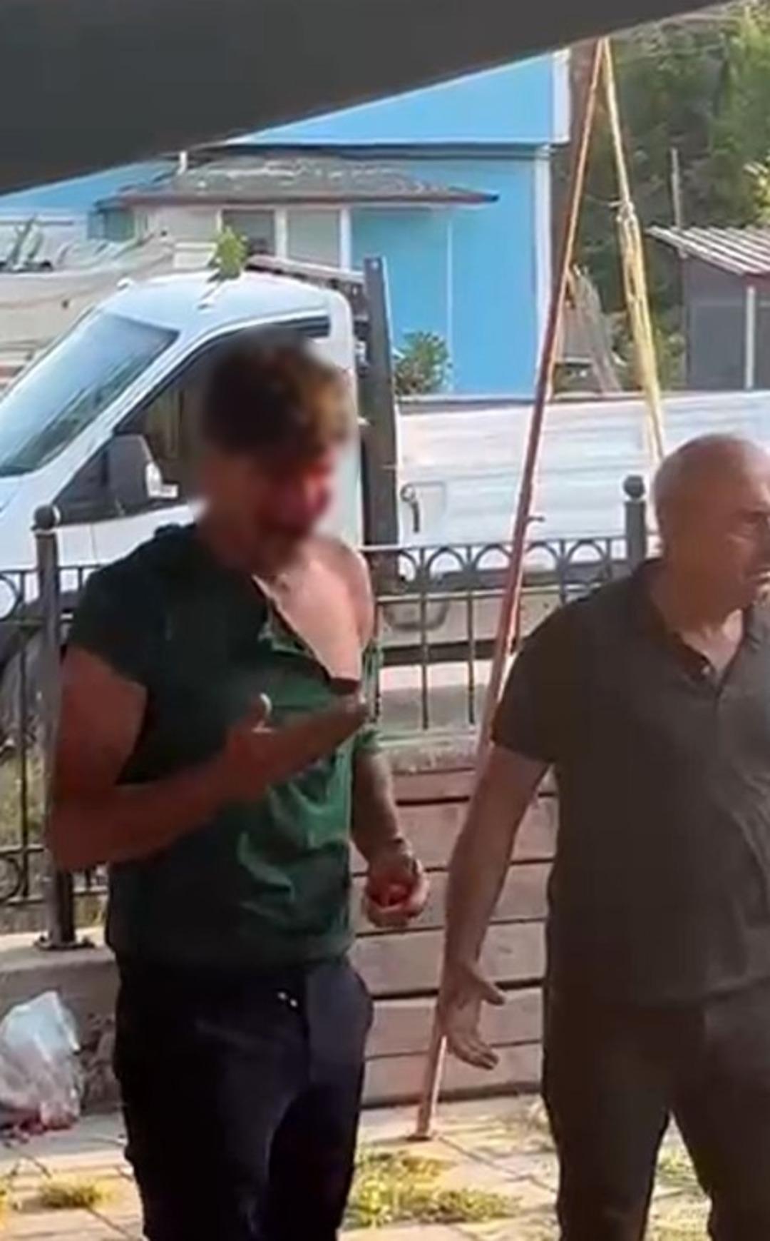 Pazar yerinde kan donduran görüntü! 3 kişi, bir genci tekme tokat dövdü: Kanlar içinde kaldı! 3