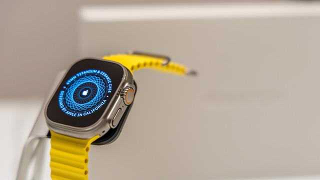 2026 Apple Watch serisi için dikkat çeken iddialar: Son yılların en büyük yükseltmesi olabilir