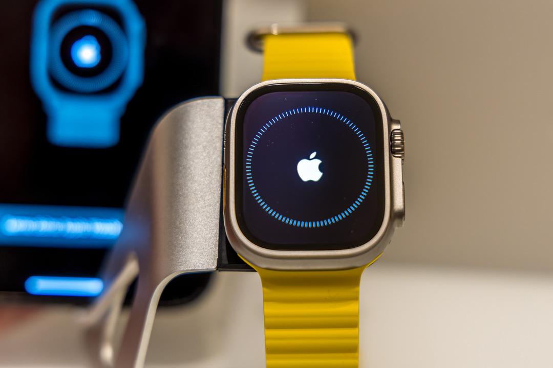 2026 Apple Watch serisi için dikkat çeken iddialar: Son yılların en büyük yükseltmesi olabilir 1
