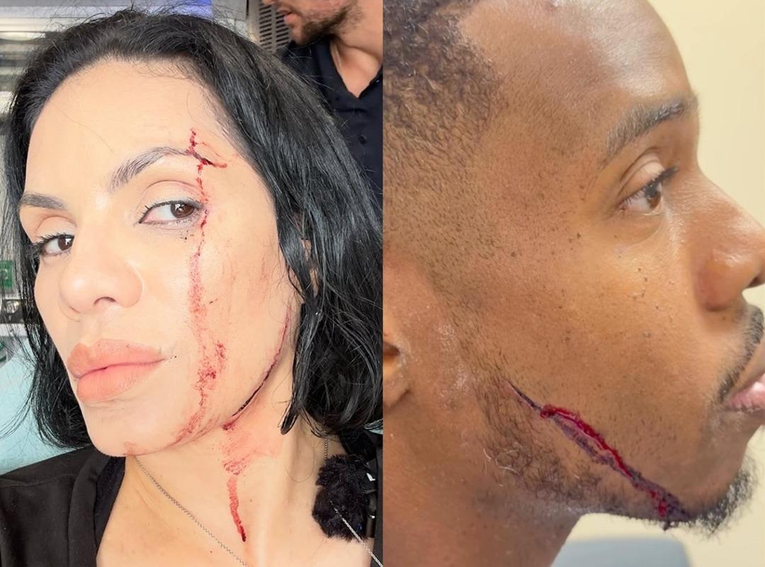 Restoranda yemek videosu çeken fenomenlere araba çarptı! O anlar olay oldu 3