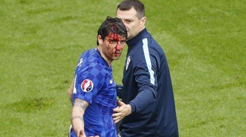 Vedran Corluka kanlar i&ccedil;inde kaldı