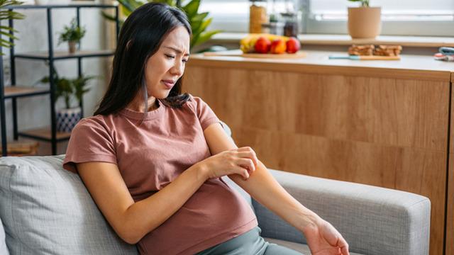 Hamilelikte kaşıntıya dikkat: Cilt sorunu değil, karaciğer hastalığı olabilir! Uzmanlar uyarıyor...