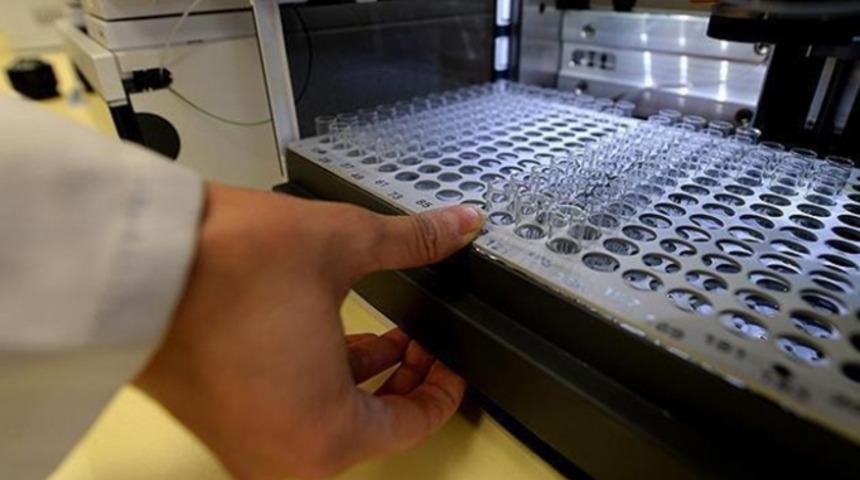 EURO 2016'da dopinge rastlanmadı