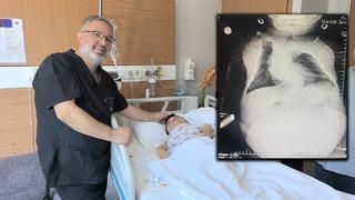 24 kiloluk kadının içinden çıktı: 20 santim boyutunda tam 3 kilo! Gaz sıkışması dedikleri devasa kist çıktı