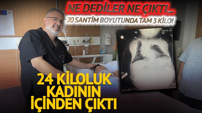 Kadının içinden çıktı: 20 santim boyutunda tam 3 kilo!