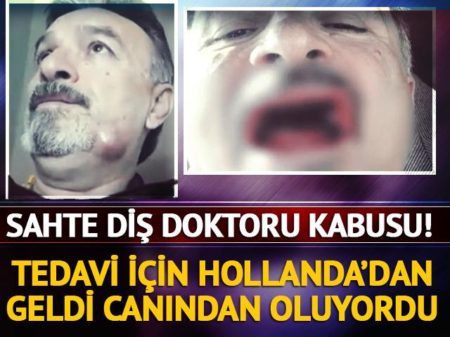 Hollanda'dan tedavi için geldi kabusu yaşadı! Sahte diş doktoru yüzünden canından oluyordu