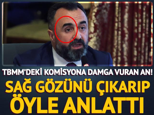 TBMM’deki komisyona damga vuran an! Sağ gözünü çıkarıp öyle anlattı
