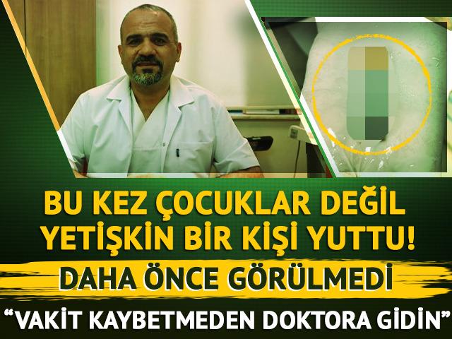 Daha önce görülmedi! Pili bu kez çocuklar değil yetişkin bir kişi yuttu