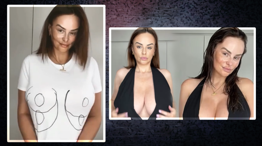 Rhian Sugden meme küçültme ameliyatı geçirdi! Aynı elbiseyi giyip before-after yaptı