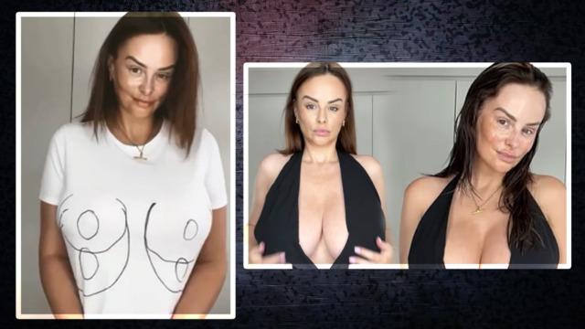 Rhian Sugden meme küçültme ameliyatı geçirdi! Aynı elbiseyi giyip before-after yaptı