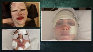 Güney Kore'ye gitti! Kim Kardashian yüzünü yaptırdıklarıyla merak edildi