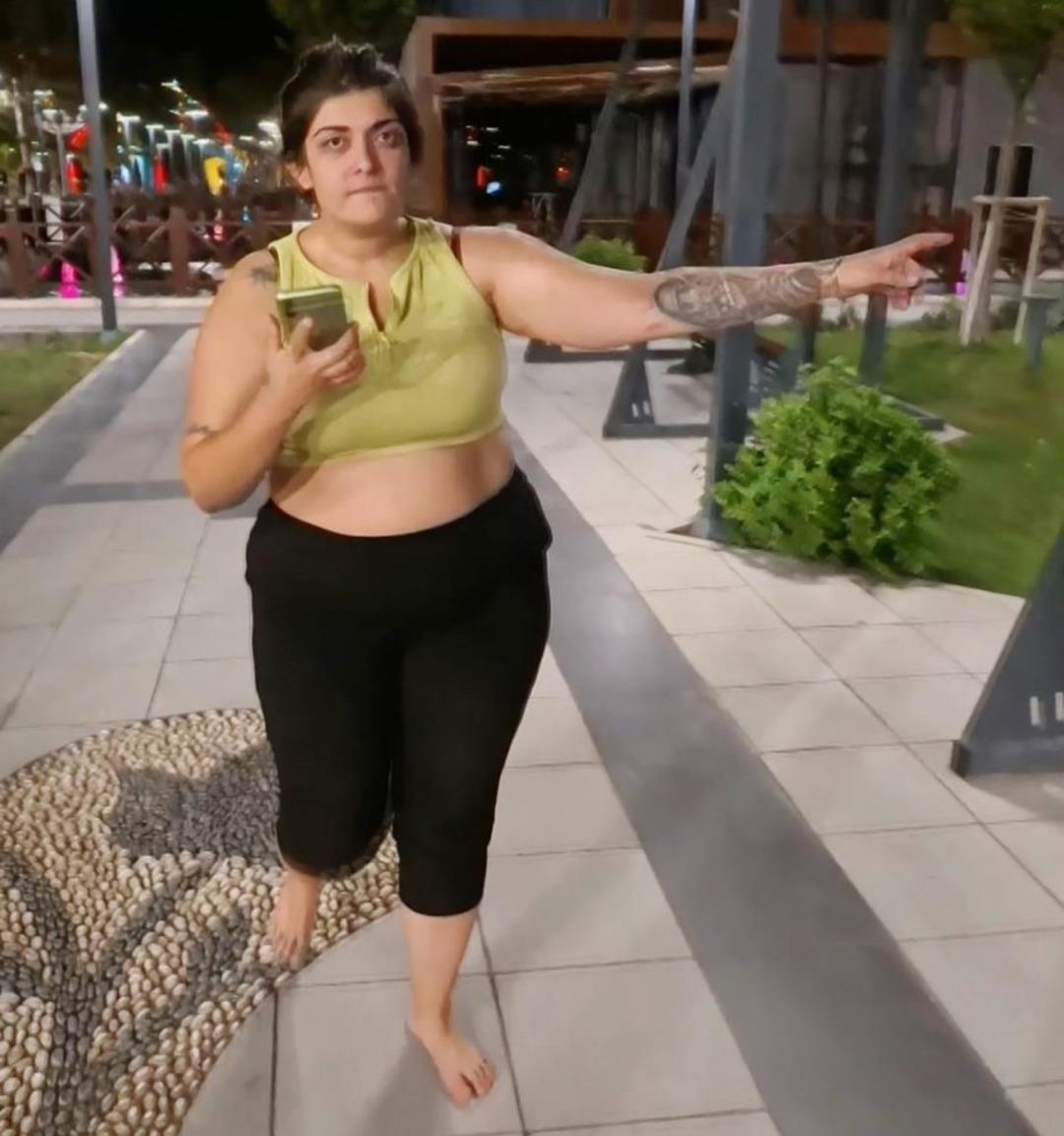 Ortalığı birbirine kattı! "Tecavüz ediyorlar" diye çığlık attı, yardıma gelenleri darbetti 2