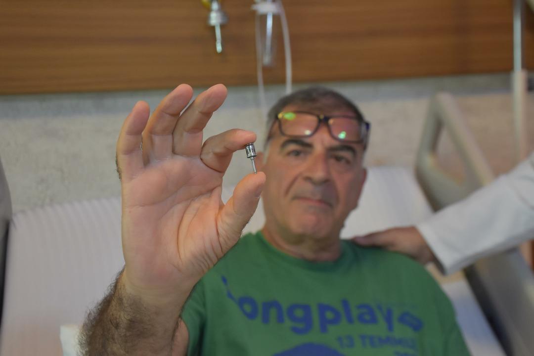 Fue al hospital quejándose de tos y sufrió el shock de su vida: ¡le quitaron un implante dental del pulmón!
