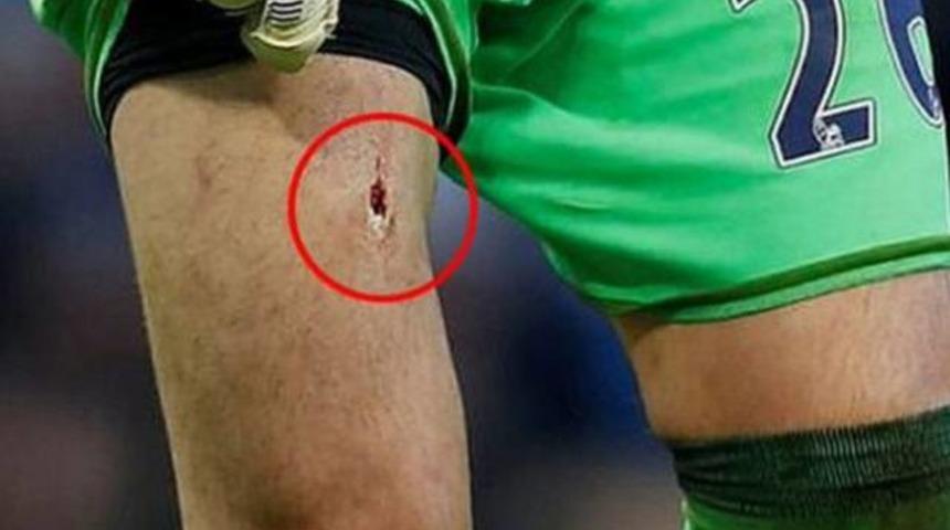 Victor Valdes'in ma&ccedil;ta bacağı delindi