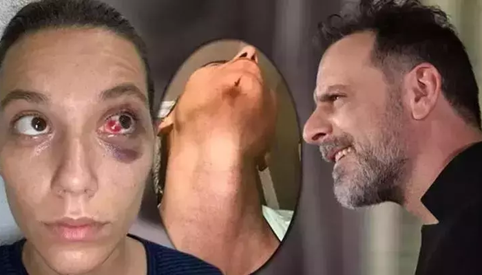 Tepki yağdı! Yeni projeden ayrılmak zorunda kaldı