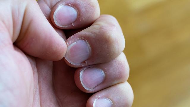 Uzman isimden kritik uyarı: Tırnaklarda başlayan tehlike! 'Fark etmeden diş köklerini eritiyor'