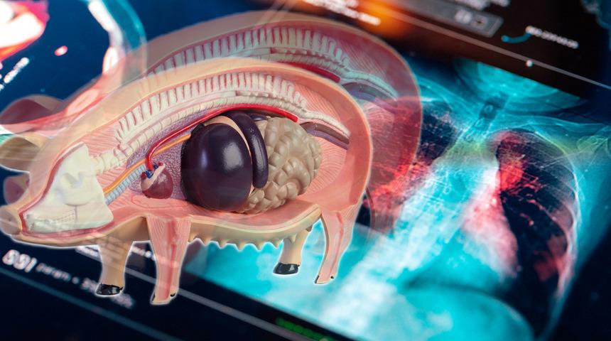 Tıp dünyasında bir ilk: Domuzdan insana akciğer nakli! Beyin ölümü gerçekleşmişti ancak 9 gün canlı kaldı...