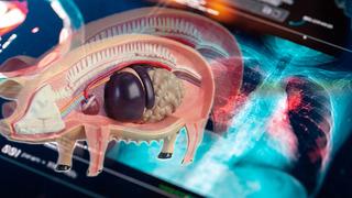 Tıp dünyasında bir ilk: Domuzdan insana akciğer nakli! Beyin ölümü gerçekleşmişti ancak 9 gün canlı kaldı...