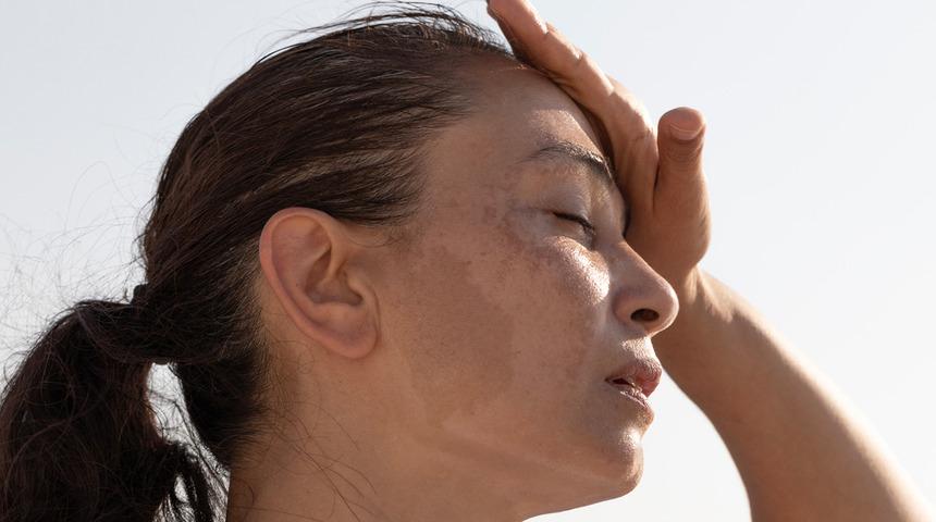 Sıcak hava deyip geçmeyin! Araştırmalar ortaya koydu: Yaşlanma hızını artırıyor!