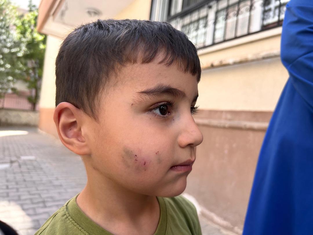 Evinde uyurken kabusa uyandı! Ankara da bir çocuğu lağım faresi ısırdı 2