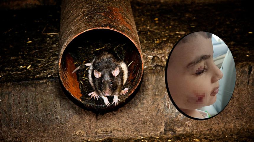 Evinde uyurken kabusa uyandı! Ankara'da bir çocuğu lağım faresi ısırdı