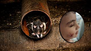 Evinde uyurken kabusa uyandı! Ankara'da bir çocuğu lağım faresi ısırdı