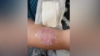 Büyükçekmece'de 'yok artık' dedirten olay! Sigara dumanı tartışmasında kolunu ısırdı