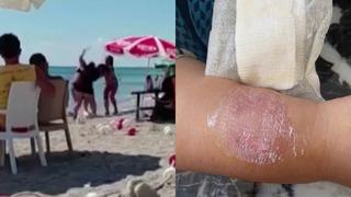 Yer: Büyükçekmece! Plajda birbirlerine girdiler: Üst üste dövüşüp kolunu ısırdı...