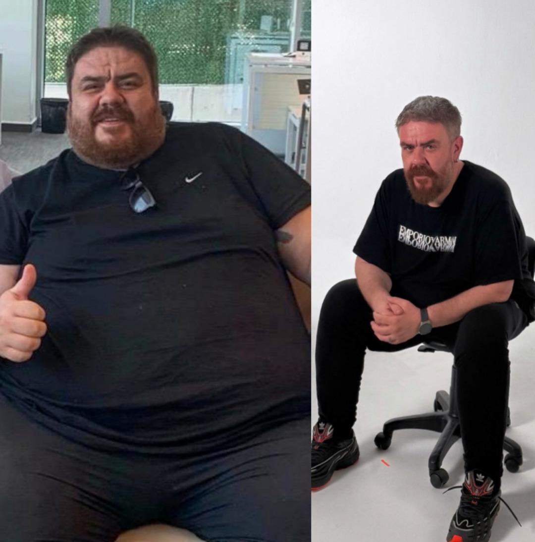 Komedyen Emre Mutlu 133 kilo verdi! Son halini paylaşınca gündem oldu 3