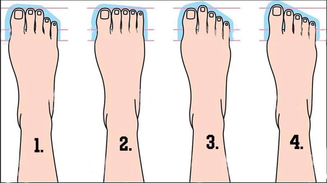 Bunları not al! Ayakkabı seçiminde dikkat edilmesi gerekenler 1