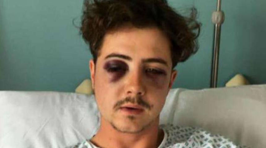 Chelsea taraftarı, kendi taraftarının kafatasını kırdı!