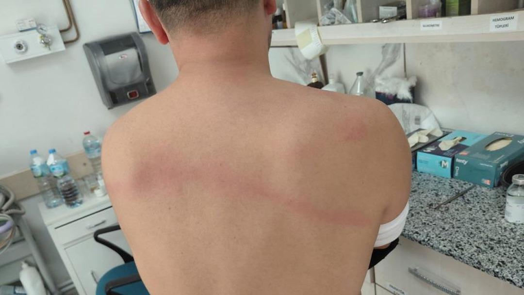 Belediye başkanından dayak skandalı! Zabıtanın sırtında sopa kırdı: "Can güvenliğimizden endişeliyiz" 5