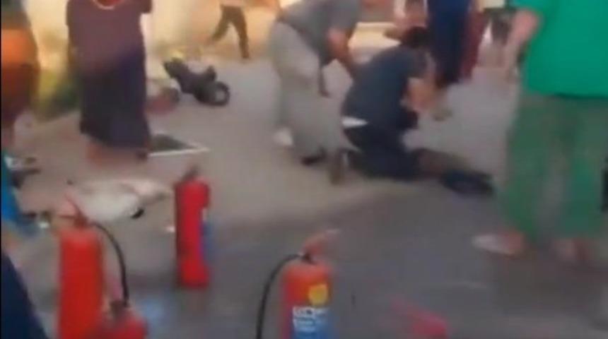 Yangında ağır yaralanan çocuk hayatını kaybetti