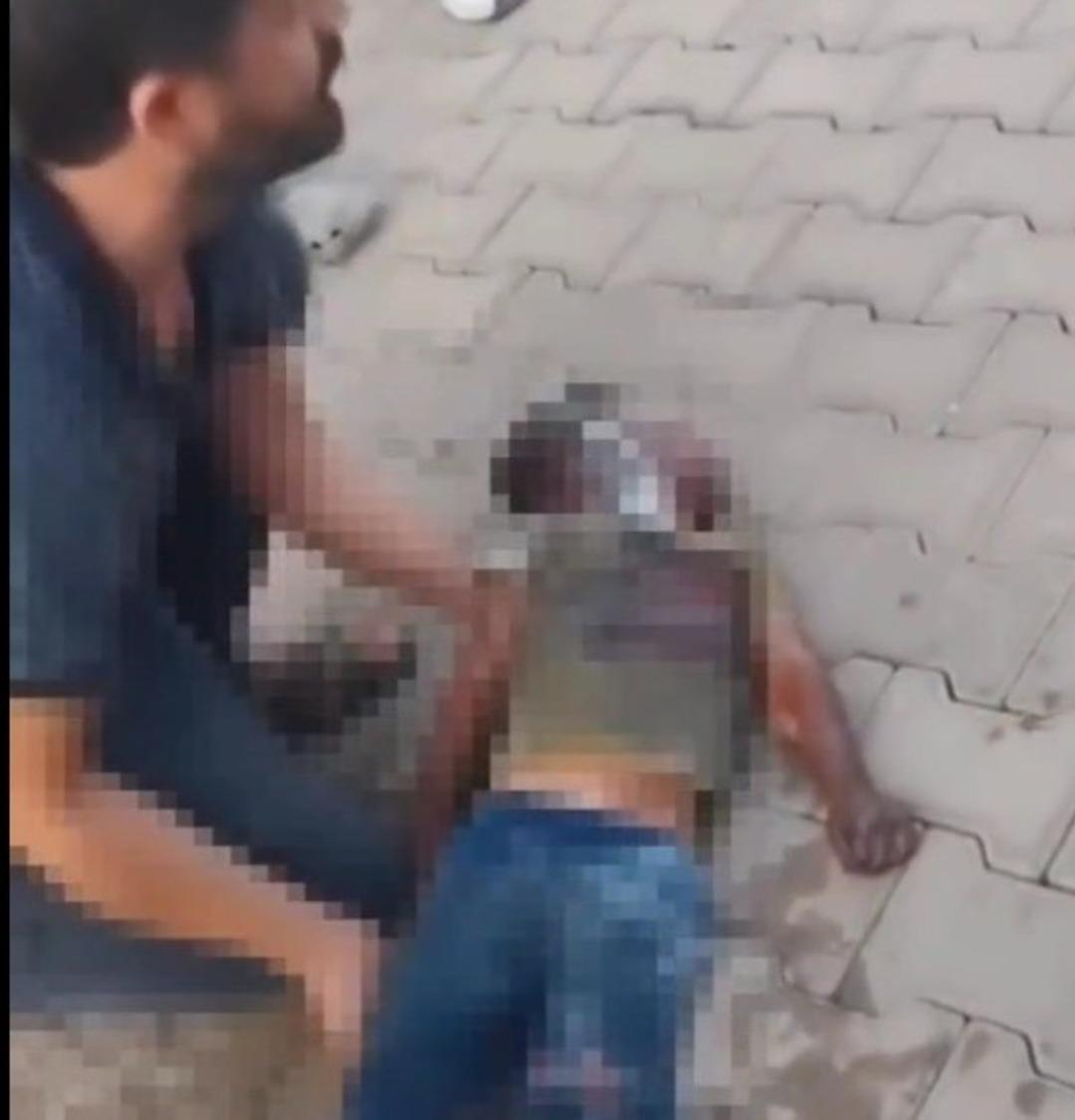 Yangında ağır yaralanan çocuk hayatını kaybetti 1