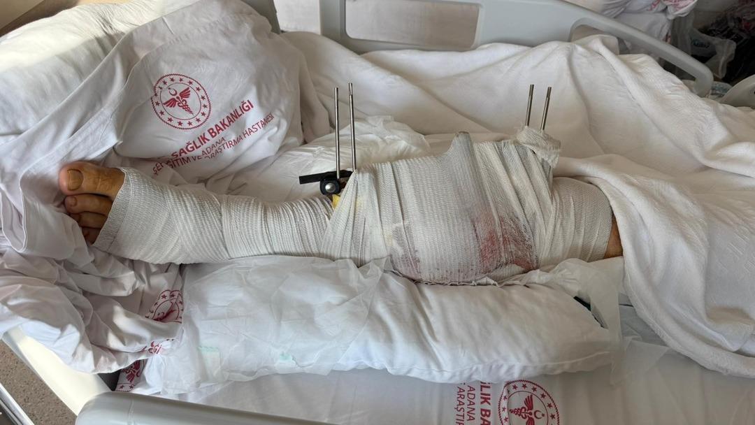 Adana da kayınpeder dehşeti! Evlilik hazırlığı yapan eski damadını vurdu 1