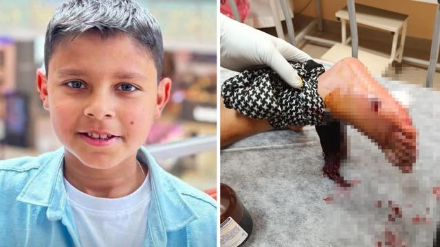 Balkonda oturan çocuğa kurşun isabet etti