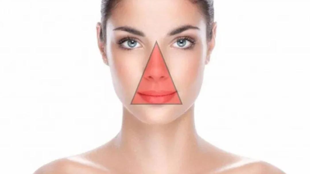  Ölüm Üçgeni nde sivilcesini patlatan kadın yüz felci geçirdi! Neredeyse canından oluyordu 1