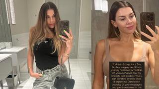 Dünyaca ünlü isimler Türkiye’ye estetik için akın ediyor! İngiltere’nin ünlü mankeni Imogen Thomas estetik için Türkiye’de...