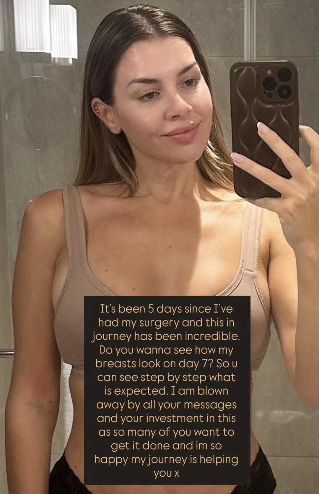 Dünyaca ünlü isimler Türkiye’ye estetik için akın ediyor! İngiltere’nin ünlü mankeni Imogen Thomas estetik için Türkiye’de... 2