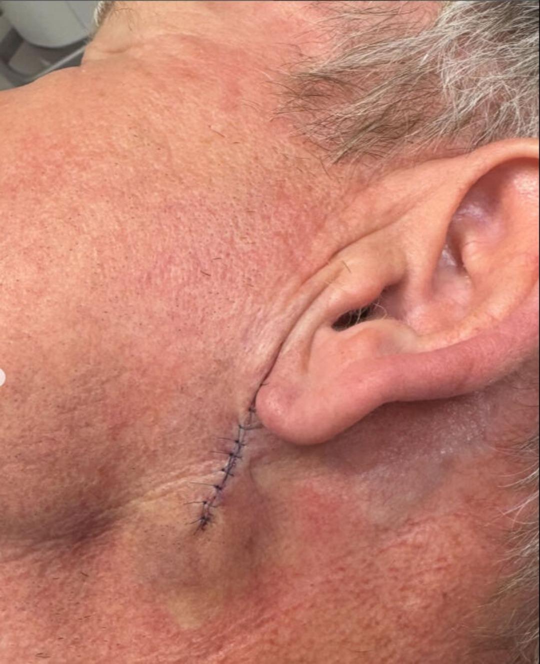 Dünyaca ünlü şef Gordon Ramsay den sevenlerini üzen haber! Hastalığını açıkladı 1