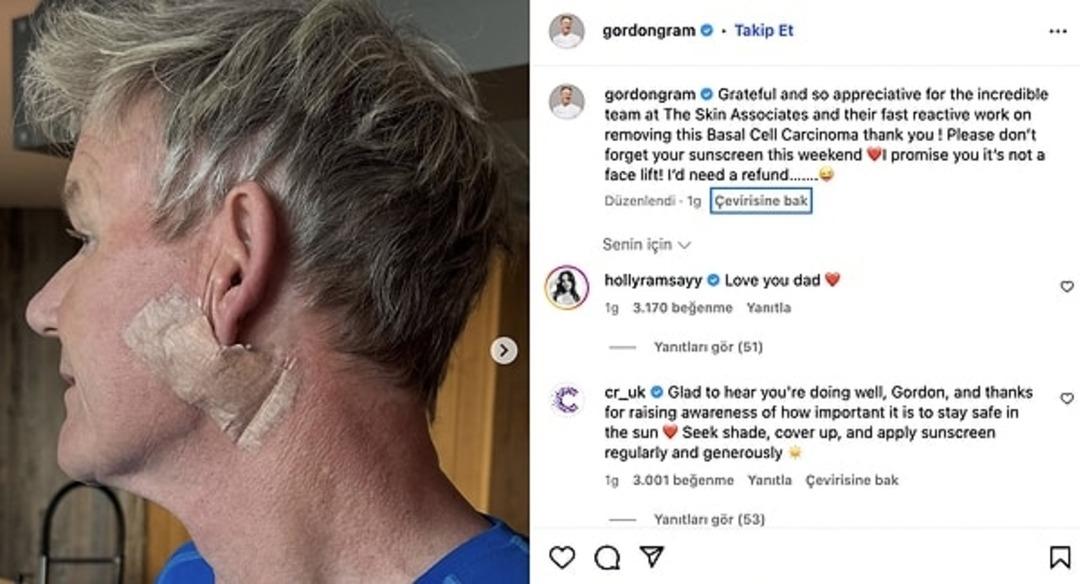 Dünyaca ünlü şef Gordon Ramsay den sevenlerini üzen haber! Hastalığını açıkladı 2