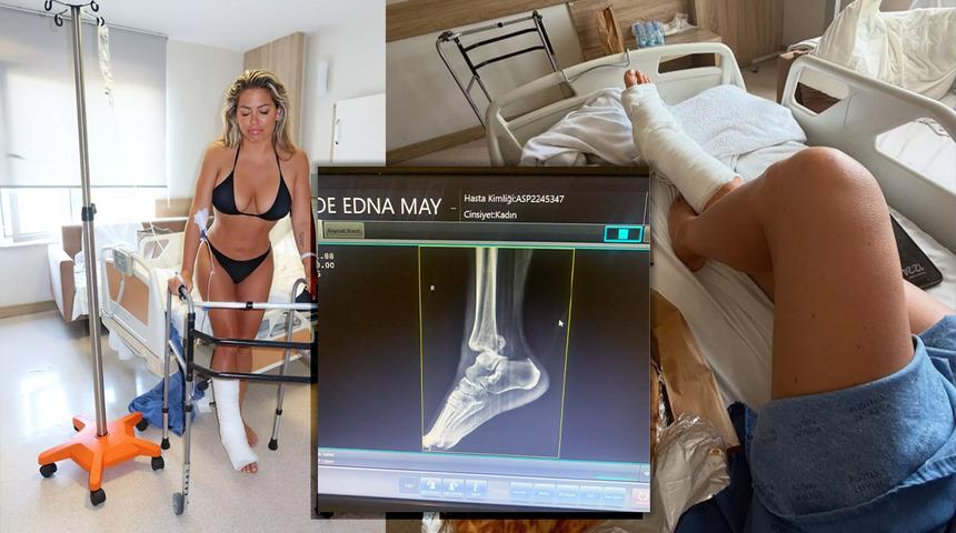 Ünlü model Türkiye tatilinde ayak bileğini kırdı... Bikinili pozunun altına yorum yağdı!