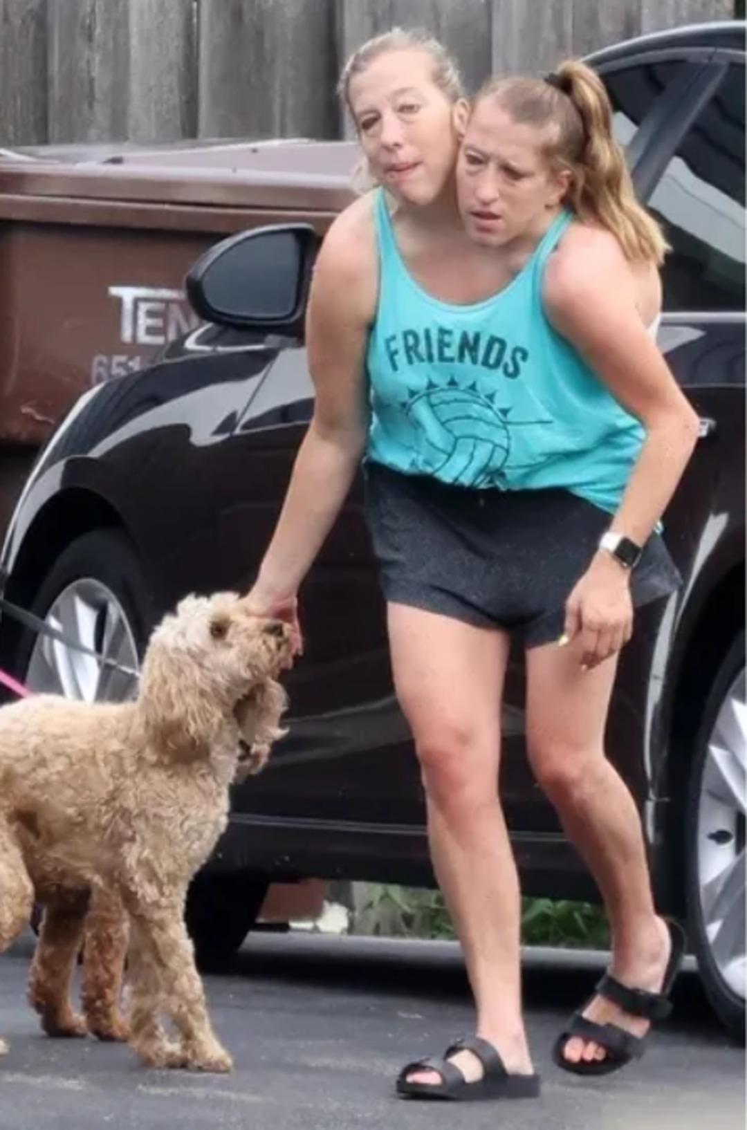 Dünyanın konuştuğu ikizler: Paylaşımları olay olmuştu... Sessizliklerini bozdular! 4